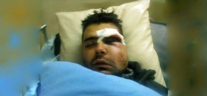 Ինչու են Հայաստանում բռնության ենթարկում սիրիահայերին. Պատերազմի կրակից դուրս` նոր մարտահրավերների առաջ