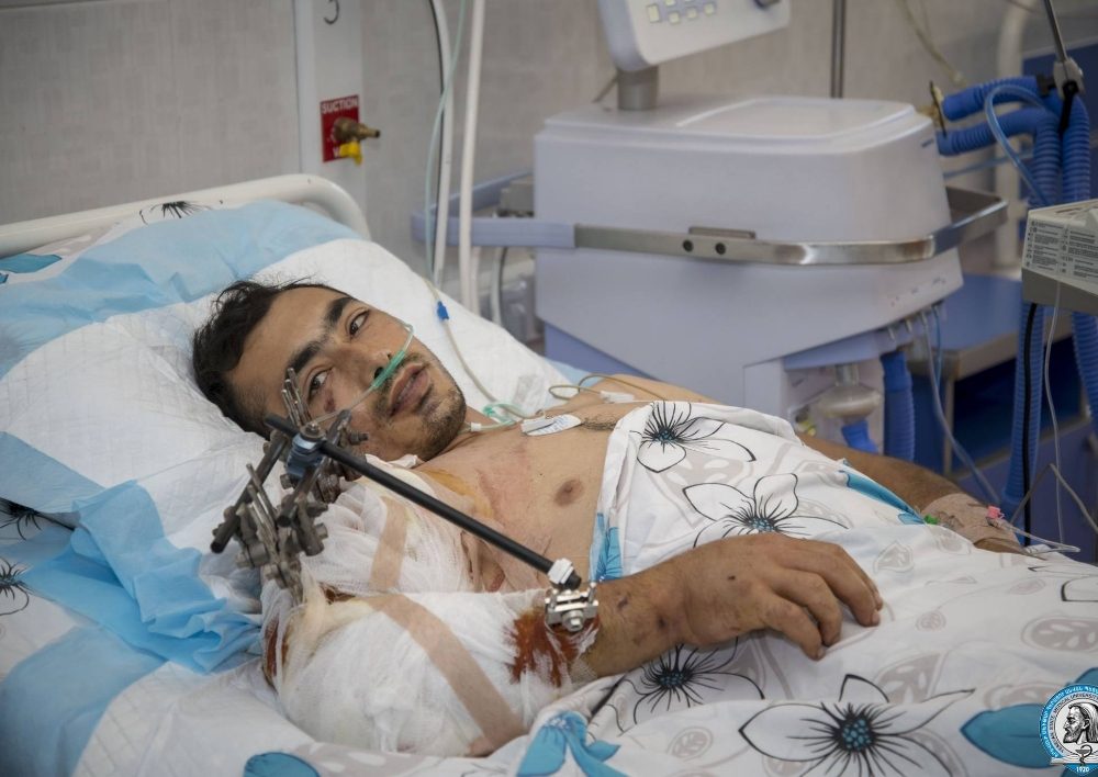 Բացառիկ վիրահատություն՝ բարեհաջող ելքով. հայ բժիշկներին հաջողվել է վերականգնել երիտասարդի կտրված ձեռքը